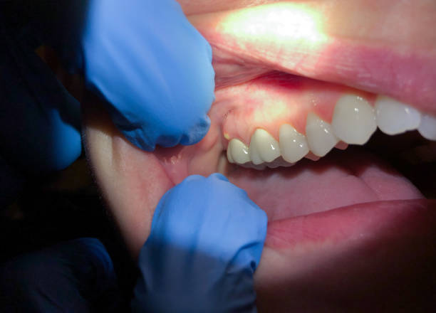 Best Pediatric Emergency Dentist in Westville, OK