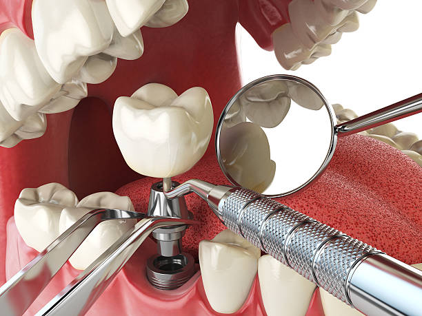 Best Emergency Dentist for Knocked-Out Tooth in Westville, OK